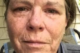 Fundraiser for Kim Thoms by Fred Dupree : Help Kim reclaim her Health