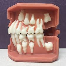 We did not find results for: Baby Teeth After Age 13 Are A Serious Problem