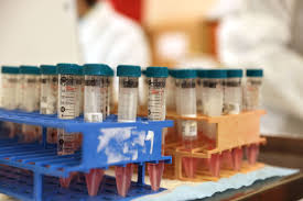 To create their vaccine, novavax researchers started with a modified spike gene. The Most Promising Coronavirus Vaccine You Ve Never Heard Of Politico
