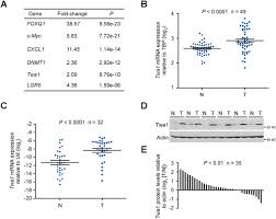 ‹ back to cheah surname. Twa1 Gid8 Is A B Catenin Nuclear Retention Factor In Wnt Signaling And Colorectal Tumorigenesis Cell Research