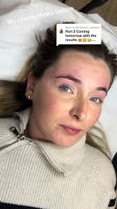 Replying to @OliviaStyle The Brow reveal 😍😍😍 the transformation is  crazy!! #browprank #part2 #combinationbrows #spmu #ombrebrows #tattoo #fyp  #brows #browtech #powderbrows #hairstrokes #essex #london ...