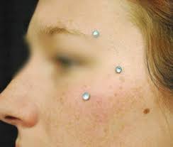 Check spelling or type a new query. Dermal Piercing Pictures Procedure Aftercare And Risks Tatring