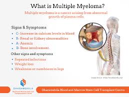 Know About Multiple Myeloma And Its Sign And Symptoms Multiple Myeloma Is A Cancer Arising From Abnormal Growth Of Multiple Myeloma Myeloma Signs And Symptoms