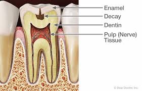 Image result for Tooth Pain