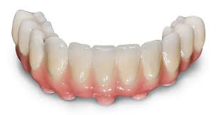 Check spelling or type a new query. Dental Bridge Is Broken What Do I Do Now