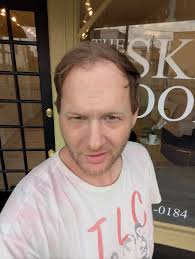 Delete if not allowed)