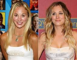 Pin On Celebrities Cosmetic Plastic Surgery