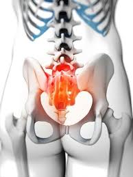 Pin On Extreme Lower Back Pain