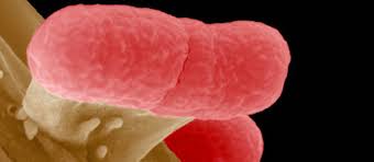 Escherichia coli, more commonly abbreviated as e. E Coli Secrets Et Mysteres D Une Bacterie Tueuse Le Point