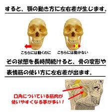 あれ 口が曲がってる と気になった時に知りたい原因と対処法 裏技ビューティー 顎関節症 顔