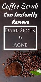 Coffee Face Scrub To Get Rid Of Dark Spots And Pigmentation On Your Face Pigmentation Coffee Scrub Face Glow Coffee Face Scrub Face Scrub Coffee Scrub Diy