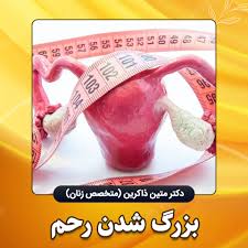 چه چیزی باعث شقاق مقعدی می‌شود + پماد برای ترک واژن-شقاق واژن