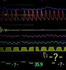 Image result for End-Tidal O2