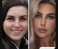 AFFIRM 🪞✨I'm not ugly I'm just poor In all seriousness, I think Paige  Lorenz is gorgeous. But I find myself at 34 with no Botox, frizzy thin  hair, crooked teeth, pointy nose