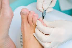 Problemas Mas Comunes En Las Unas De Los Pies Causas Y Tratamientos Podoactiva Lideres En Podologia