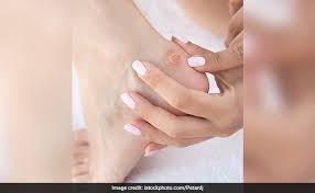 How to use baking soda as a treatment for feet calluses, foot odor, and cracked heelsby the end of a working day, most people feel tired, in pains, and bad. 7 Best Home Remedies For Calluses And Corns