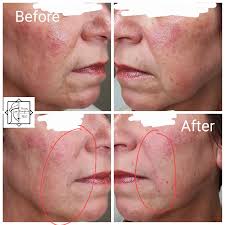 Beauty Resurfaced, PLLC