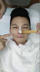 Nose Filler Injection by Esme Clinic