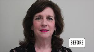 WPS Patient Testimonial: Facelift