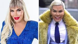 Celso santebañes, de 20 años, quería parecerse al famoso novio de la barbie, pero nunca pensó que la cirugía plástica le perjudicaría hasta el punto de perder la vida este jueves. Ken Humano Se Assume Mulher E Deixa Fas Em Choque Sou A Barbie Aqui Noticias