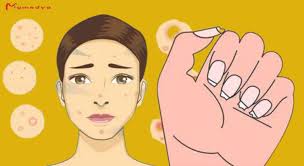 Signs of gluten sensitivity