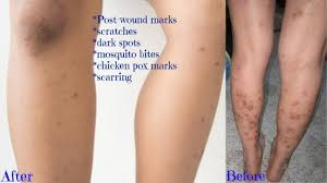 Here is how you can use some of these oils to get rid of your dark neck. Pin On Skin Care New