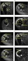 Image result for Shoulder Imaging