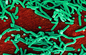 Los dos virus son originarios de áfrica, donde se han presentado brotes esporádicos durante décadas. Diferencias Entre El Ebola Y Marburgo Sooluciona
