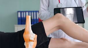 Image result for Knee Bulge Sign
