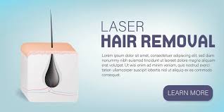 Although we allow one offs, laser hair removal is a procedure that requires a series of treatments to be effective. View Of Human Skin With Hair Removal Hair Procedure 3d Vector Realistic Illustration Poster Stock Vector Adobe Stock