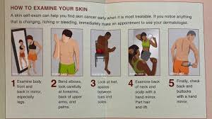 Image result for Self Skin Exam