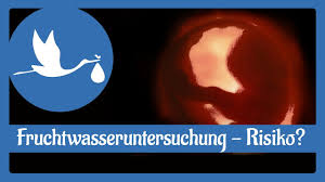Eine fruchtwasseruntersuchung ist nicht ungefährlich. Schwangerschaft Die Fruchtwasseruntersuchung Risiko Youtube