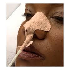 Buy Dale Large/Adult NasoGastric Tube Holder #160 at Medical Monks!