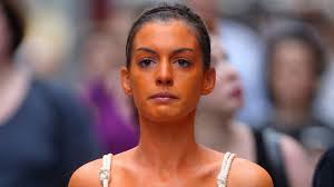 I would go through fort nugent park which right next to our neighborhood. How To Apply Self Tanner Without Streaks Or Blotches Glamour