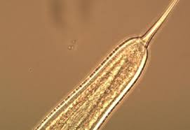 Image result for Pinworm