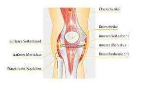 Ursachen und risikofaktoren eines meniskusrisses. Meniskusverletzung Dr Med Burkhard M Delsmann Facharzt Fur Orthopadie Sportmedizin Chirotherapie Akupunktur