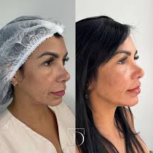 A verdadeira beleza é se sentir feliz e confiante ao se olhar no espelho.  Iniciamos um cuidado especial para realçar ainda mais sua beleza natural.  Hoje, destacamos detalhes que fazem toda diferença: