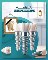 عيادات ديمه لطب الأسنان بالرياض Dima Dental Centers