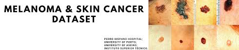 It affects people of all races, genders and ages, which is why it's absolutely critical for americans to learn about. Skin Cancer Melanoma Image Data Kaggle