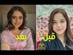 مشاعل الشحي تكشف تطورات حالتها الصحية وتوجه رسالة لمحبيها Ù…Ø´Ø§Ø¹Ù„ Ø§Ù„Ø´Ø­ÙŠ ØªØ«ÙŠØ± Ø§Ù„Ø¬Ø¯Ù„ Ø¨Ø¹Ø¯ ØªØºÙŠÙŠØ± Ù…Ù„Ø§Ù…Ø­Ù‡Ø§ Youtube