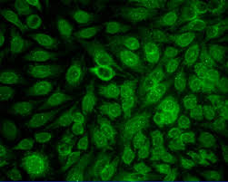 Image result for ANA Staining Pattern