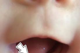 Wann kommen die ersten milchzähne? Erster Zahn 4 5 Monate Forum Baby Urbia De