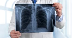 Check spelling or type a new query. Warning Signs Of Pneumonia Urgentmed Network