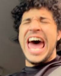 365 days with nice photos… and Kobe getting a bug in his eye ❤️❤️, RIP bug