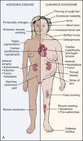 Screening For Endocrine And Metabolic Disease Musculoskeletal Key