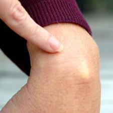Ganglion Am Handgelenk Was Bei Einem Uberbein Hilft Gesundheit
