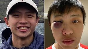 End the Virus of Racism