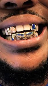 We did not find results for: Gold Grillz Explore Tumblr Posts And Blogs Tumgir