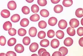Image result for Red Blood Cell