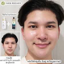 เซรั่มยอดนิยมจาก Yves Rocher เพื่อผิวใสสุขภาพดี